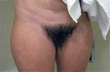 Super Hairy Bush Picture 3 Uploaded By Capricornus On ImageFap Com