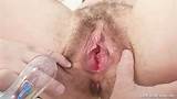 Milf Hairy Pussy Gyno Examination Hospital